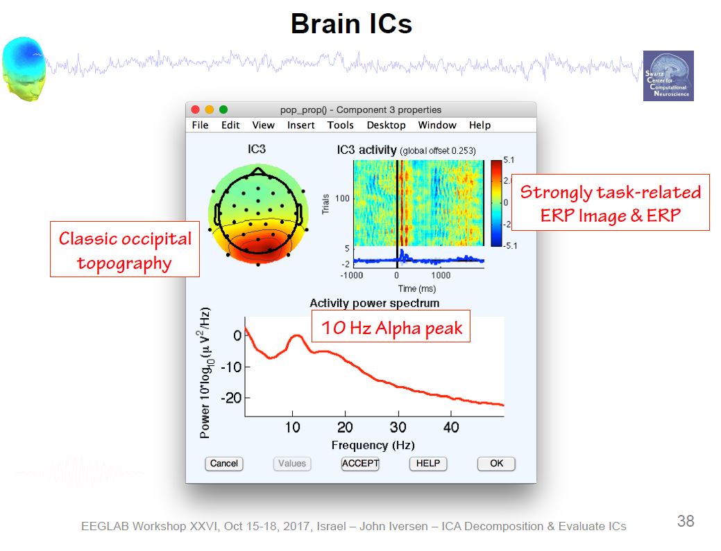 ICA Brain Activity Example 1