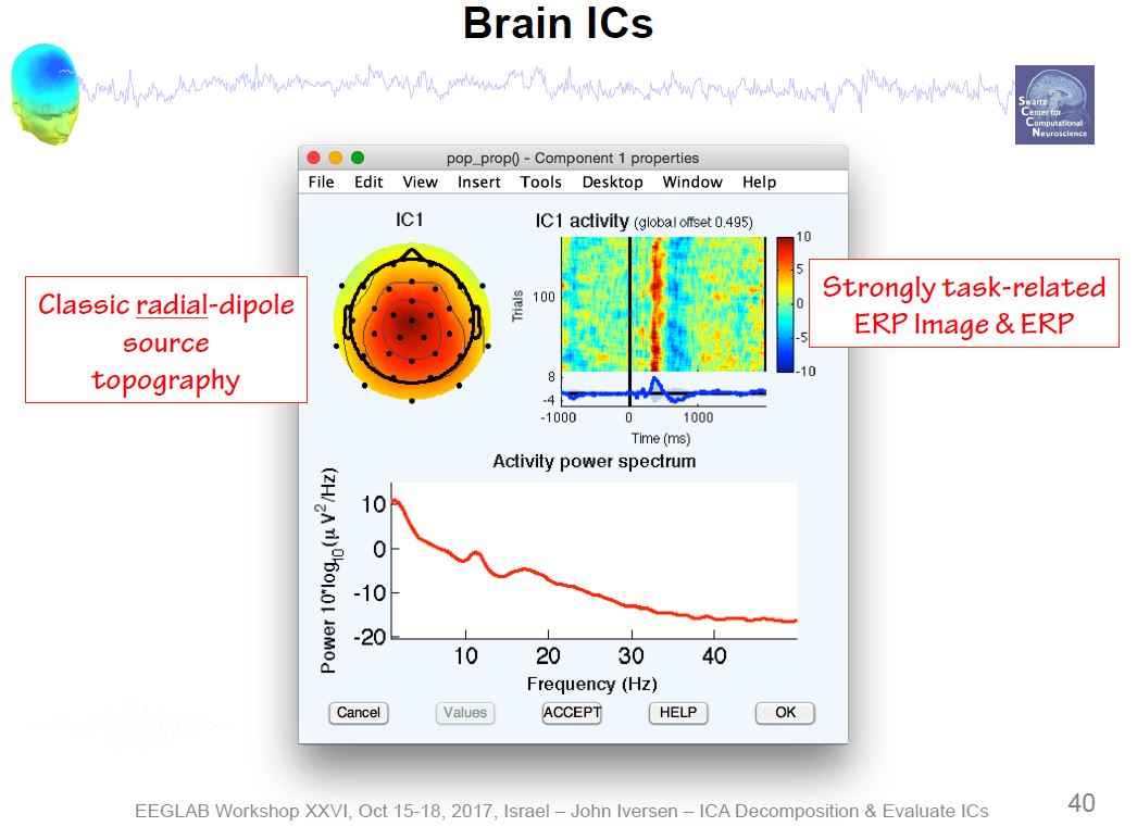 ICA Brain Activity Example 2