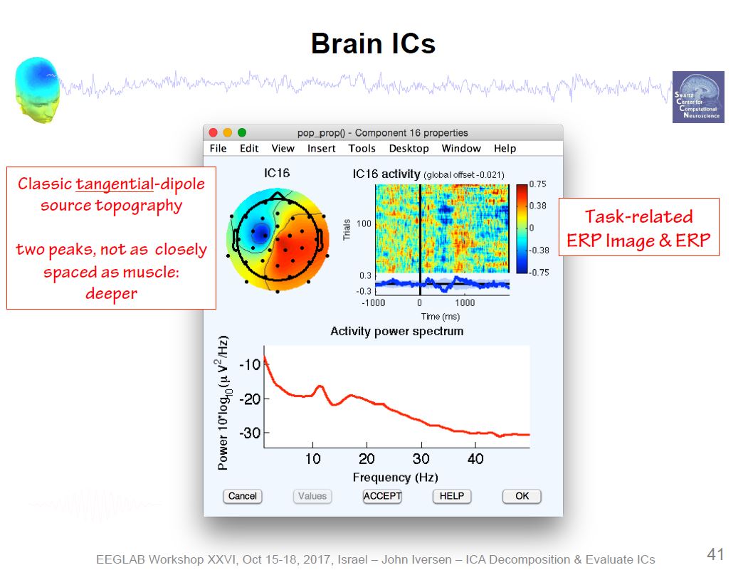 ICA Brain Activity Example 3