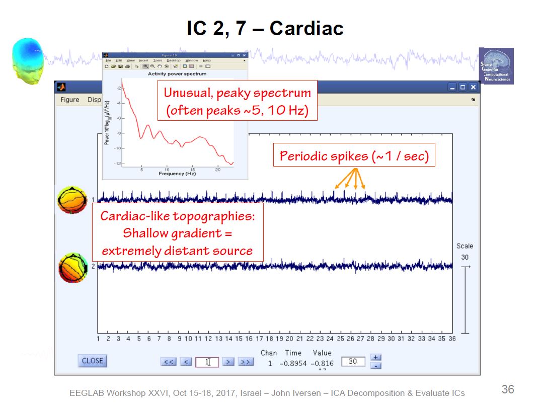 ICA Cardiac Artifact