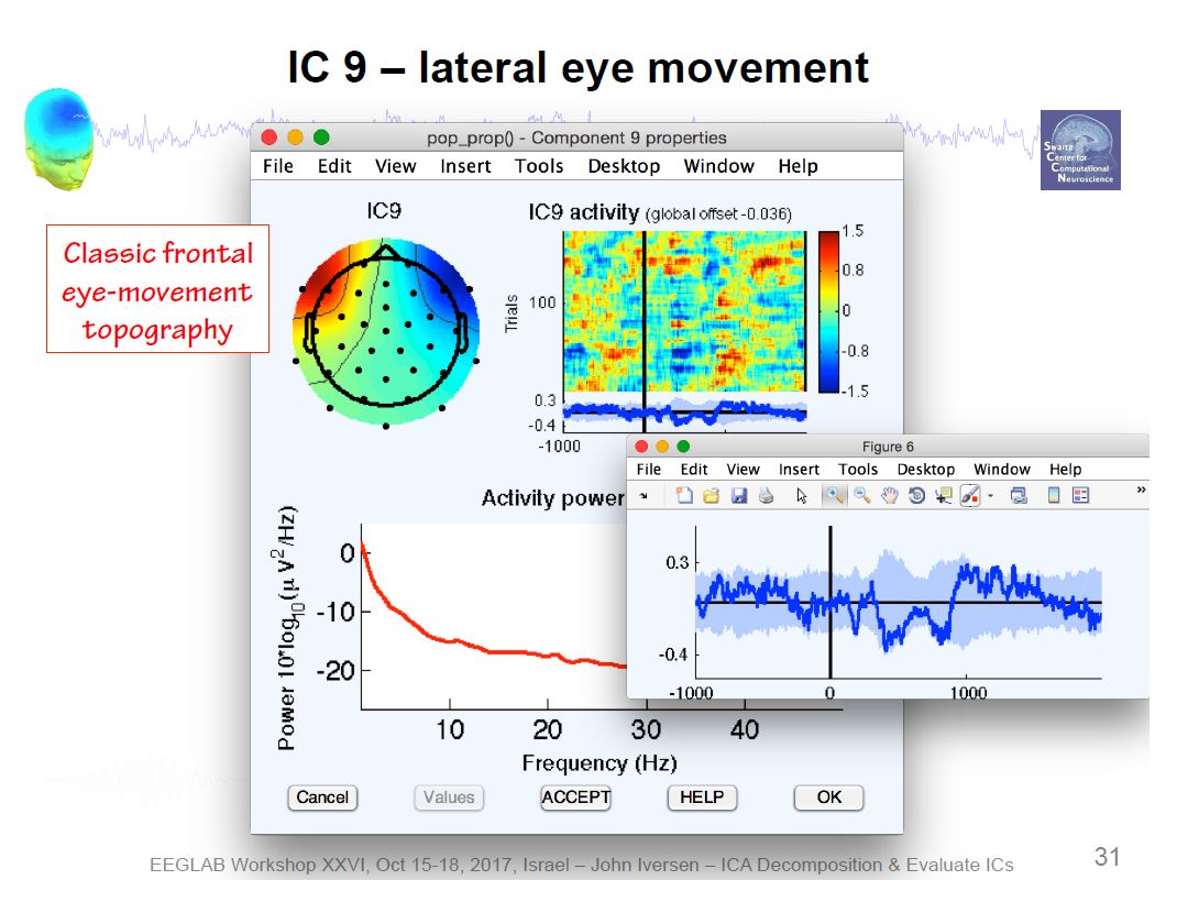 ICA Lateral Eye Movement Artifact