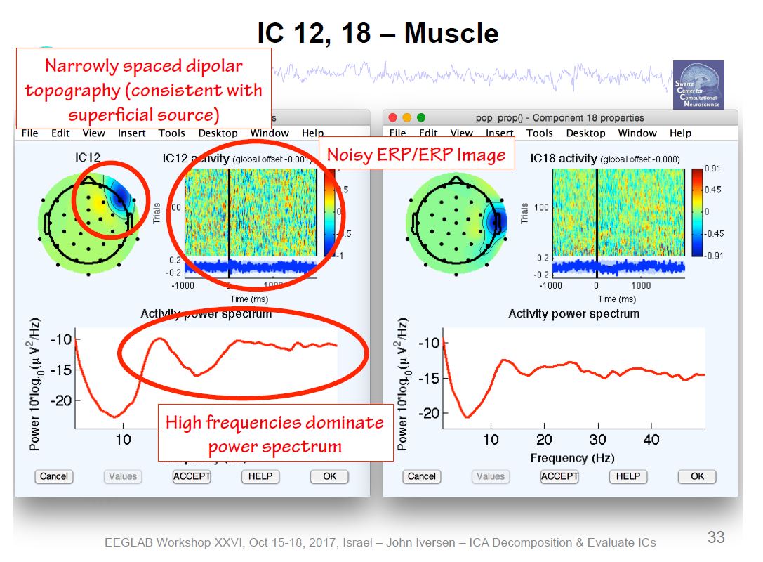 ICA Muscle Artifact